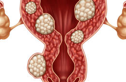 检查发现子宫肌瘤如何控制它生长