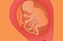 胎盤植入怎么辦，這種技術了解一下